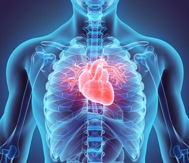 Schematische Darstellung des menschlichen Brustkorbs mit Hervorhebung des Herzens und den Herzkranzgefäßen.